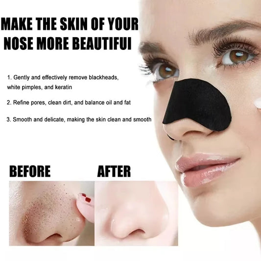 10/50/100 Pcs Blackhead Removal Nose Strips – Gentle & Effective Deep Pore Cleansing for Clear, Smooth Skin