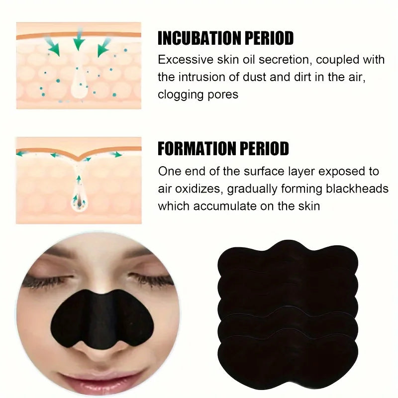 10/50/100 Pcs Blackhead Removal Nose Strips – Gentle & Effective Deep Pore Cleansing for Clear, Smooth Skin