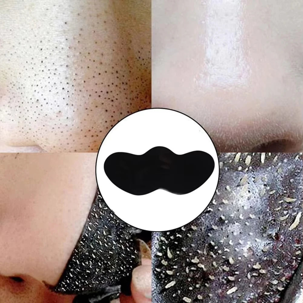 10/50/100 Pcs Blackhead Removal Nose Strips – Gentle & Effective Deep Pore Cleansing for Clear, Smooth Skin